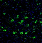 Immunofluorescence staining of mouse midbrain shows moderate neuronal positivity in the red nucleus.