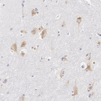 Immunohistochemical staining of human hippocampus shows moderate positivity in neurons.