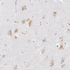 Immunohistochemical staining of human hippocampus shows moderate positivity in neurons.