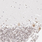 Immunohistochemical staining of human cerebellum shows moderate nuclear positivity in neurons.