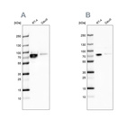 Anti-DDX3X Antibody