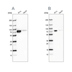 Western blot analysis using Anti-DDX3X antibody HPA001648 (A) shows similar pattern to independent antibody HPA005631 (B).