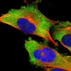 Immunofluorescent staining of human cell line U-251 MG shows localization to cytosol.