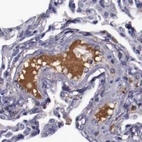 Immunohistochemical staining of human lung using Anti-APOH antibody HPA001654.