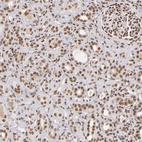 Anti-ZNF148 Antibody