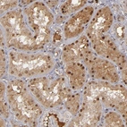 Anti-ZNF234 Antibody