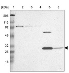 Lane 1: Marker [kDa] 206, 113, 82, 49, 32, 26, 18_br/_Lane 2: Human cell line RT-4_br/_Lane 3: Human cell line U-251MG sp_br/_Lane 4: Human cell line A-431_br/_Lane 5: Human liver tissue_br/_Lane 6: Human tonsil tissue