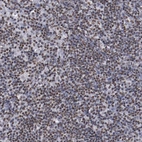 Anti-HNRNPA2B1 Antibody