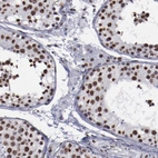 Immunohistochemical staining of human testis shows strong nuclear positivity in cells in seminiferous ducts.