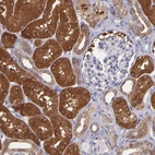 Immunohistochemical staining of human kidney shows moderate to strong cytoplasmic positivity in cells in tubules.