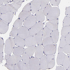 Immunohistochemical staining of human skeletal muscle shows no cytoplasmic positivity in myocytes as expected.