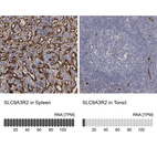 Anti-SLC9A3R2 Antibody