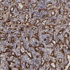 Anti-SLC9A3R2 Antibody