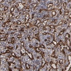 Immunohistochemical staining of human spleen shows high expression.