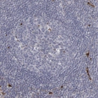 Immunohistochemical staining of human tonsil shows low expression as expected.