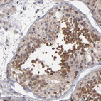 Anti-GLCCI1 Antibody