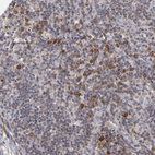 Anti-GLCCI1 Antibody