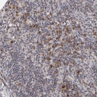 Immunohistochemical staining of human lymph node shows moderate to strong cytoplasmic positivity in non-germinal center cells.