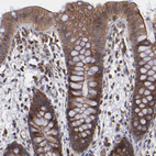 Immunohistochemical staining of human colon shows moderate to strong cytoplasmic positivity in glandular cells.