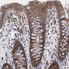 Immunohistochemical staining of human colon shows moderate to strong cytoplasmic positivity in glandular cells.