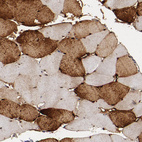 Immunohistochemical staining of human skeletal muscle shows weak to moderate cytoplasmic positivity in myocytes.