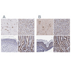 Anti-GOLIM4 Antibody