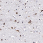Immunohistochemical staining of human cerebral cortex shows strong granular cytoplasmic positivity in neurons and glial cells.