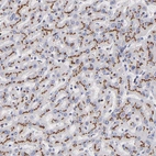 Immunohistochemical staining of human liver shows strong granular cytoplasmic positivity in hepatocytes.