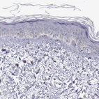 Immunohistochemical staining of human skin shows moderate granular cytoplasmic positivity in a small subset of squamous epithelial cells.