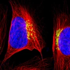 Immunofluorescent staining of human cell line U-2 OS shows localization to the Golgi apparatus.