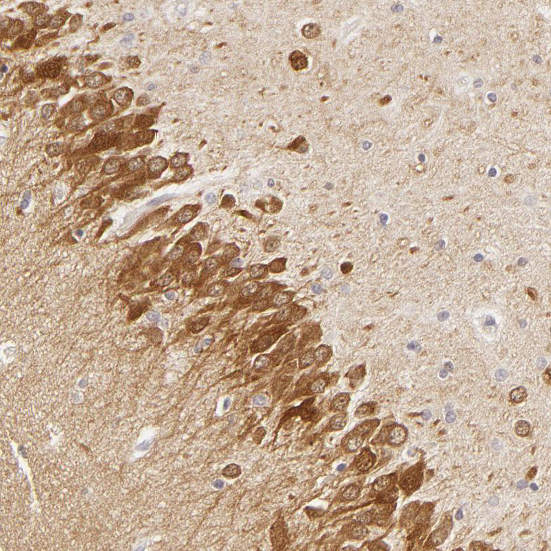 Anti-DLG3 Antibody