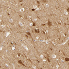 Immunohistochemical staining of human cerebral cortex shows strong cytoplasmic positivity in neurons.