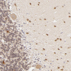 Anti-DLG3 Antibody