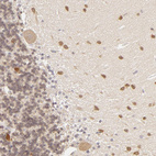 Immunohistochemical staining of human cerebellum shows strong cytoplasmic positivity in cells in molecular layer.