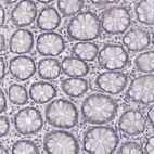 Immunohistochemical staining of human colon shows no positivity in glandular cells as expected.