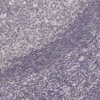 Immunohistochemical staining of human tonsil shows no positivity in glandular cells as expected.