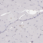 Immunohistochemical staining of human skeletal muscle shows no positivity in myocytes as expected.