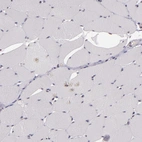 Immunohistochemical staining of human skeletal muscle shows no positivity in myocytes as expected.