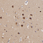 Anti-TOM1 Antibody