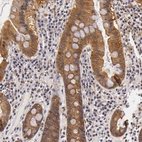 Immunohistochemical staining of human gastrointestinal shows moderate cytoplasmic positivity in glandular cells.
