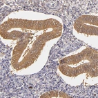 Immunohistochemical staining of human endometrium shows moderate cytoplasmic positivity in glandular cells.