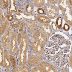 Anti-TOM1 Antibody