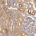 Immunohistochemical staining of human kidney shows moderate cytoplasmic positivity in cells in tubules.