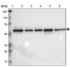 Lane 1: Marker [kDa] 207, 110, 79, 49, 32, 25, 17_br/_Lane 2: Human cell line RT-4_br/_Lane 3: Human cell line EFO-21_br/_Lane 4: Human cell line A-431_br/_Lane 5: Human liver tissue_br/_Lane 6: Human tonsil tissue