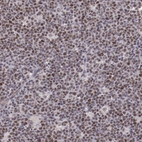 Immunohistochemical staining of human lymph node shows moderate nuclear positivity in germinal center cells.