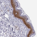 Immunohistochemical staining of human skin shows moderate nuclear positivity in squamous epithelial cells.