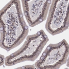 Immunohistochemical staining of human duodenum shows weak nuclear positivity in glandular cells.