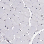 Immunohistochemical staining of human skeletal muscle shows no nuclear positivity in myocytes as expected.