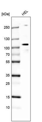 Western blot analysis in human cell line HEL.