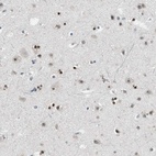 Anti-MZF1 Antibody